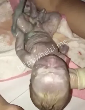 生小孩全过程视频流出