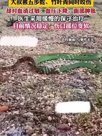 毒蛇咬伤血清过敏