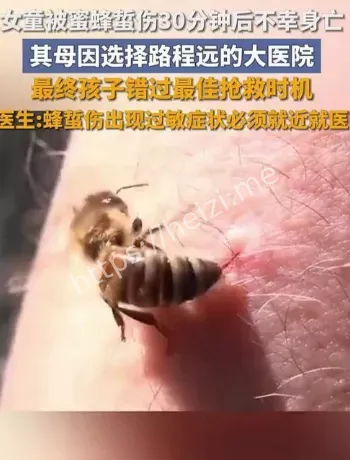 蜂蜇伤急救步骤