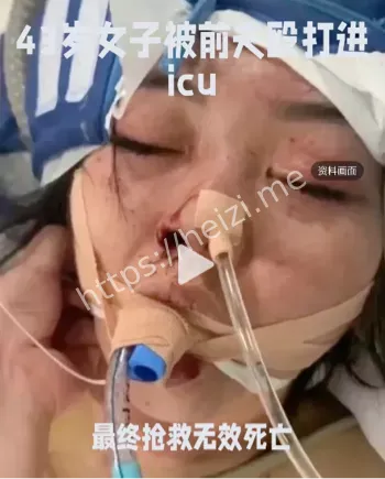 张丽萍