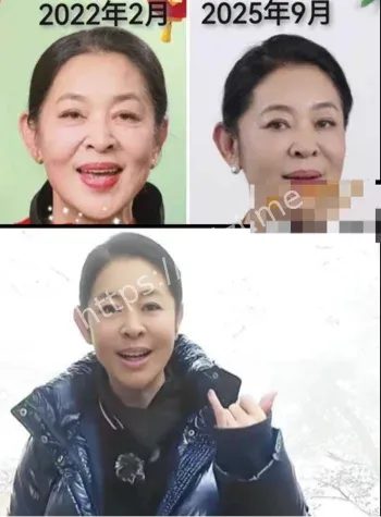 器官黑市返老还童传闻