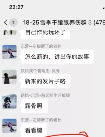 踩断腿视频
