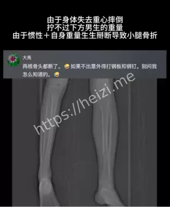 舔狗当滑雪板