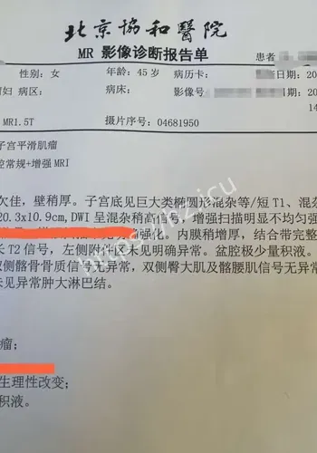 22厘米肌瘤背景补充